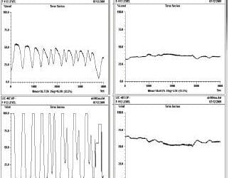 True Process Variability Costs, Causes and Cures